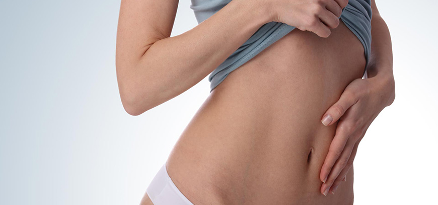 ¿Cuáles son los tipos de abdominoplastia?